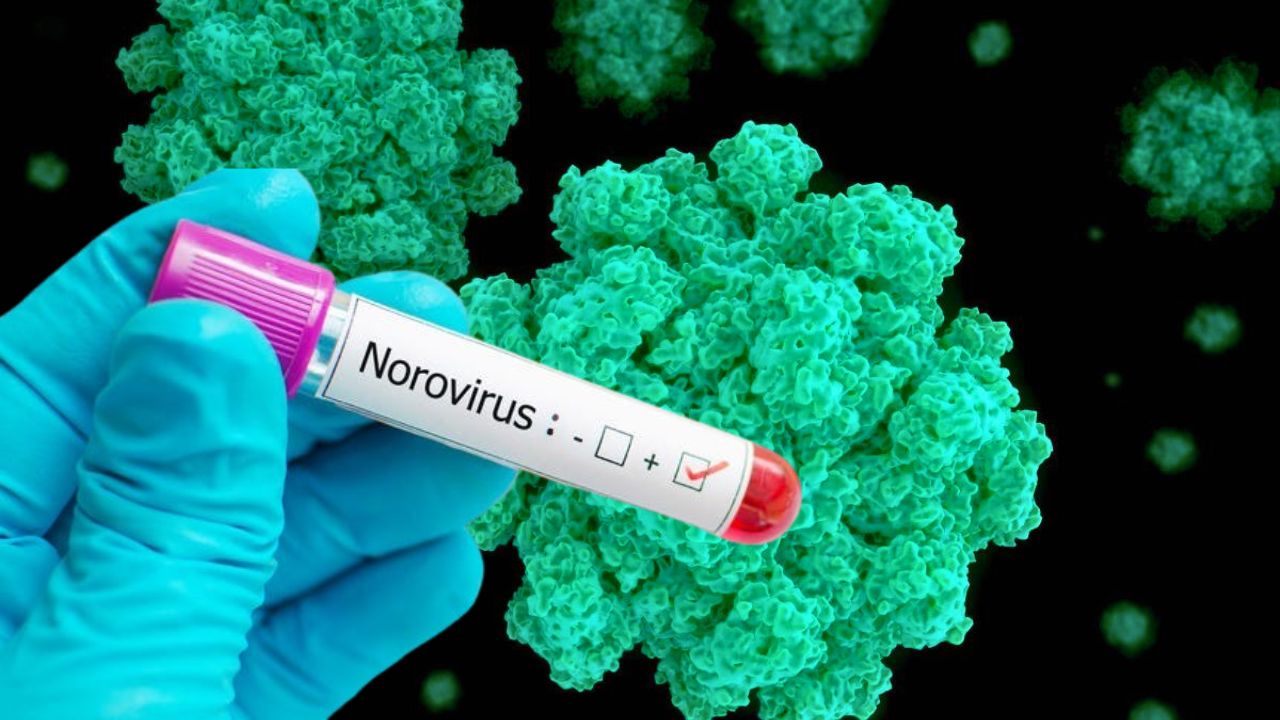 Norovirus